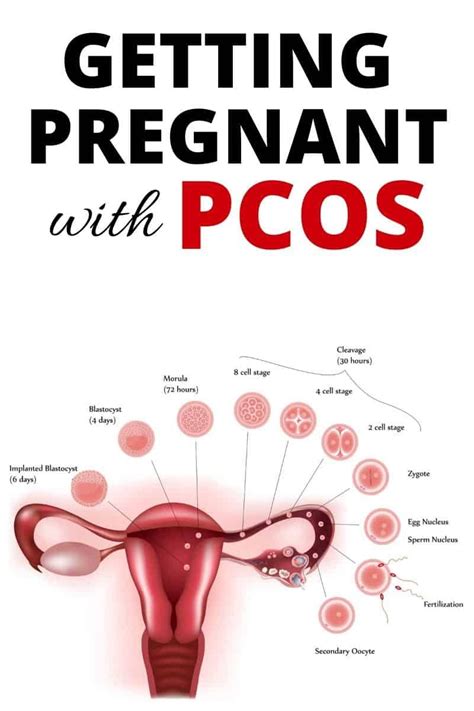 how can i get pregnant with pcos fast
