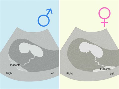 how to know whether you are pregnant with a boy or girl